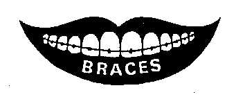 BRACES