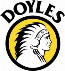 DOYLES