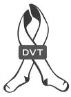 DVT