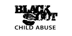 BLACK OUT CHILD ABUSE