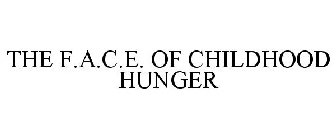 THE F.A.C.E. OF CHILDHOOD HUNGER