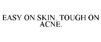 EASY ON SKIN - TOUGH ON ACNE