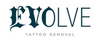 EVOLVE TATTOO REMOVAL