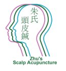 ZHU'S SCALP ACUPUNCTURE