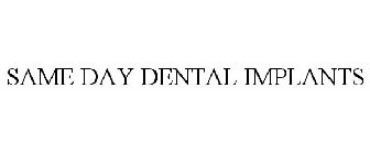 SAME DAY DENTAL IMPLANTS