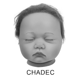 CHADEC