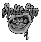 SPLIT LIP