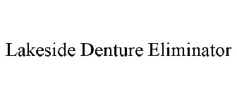 LAKESIDE DENTURE ELIMINATOR